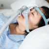 sleep apnea surgery